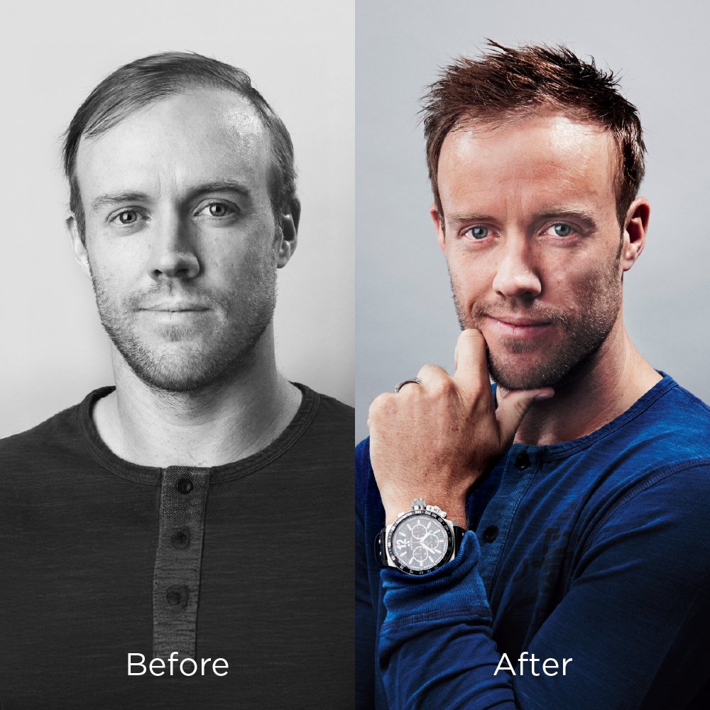 before & after photos 01