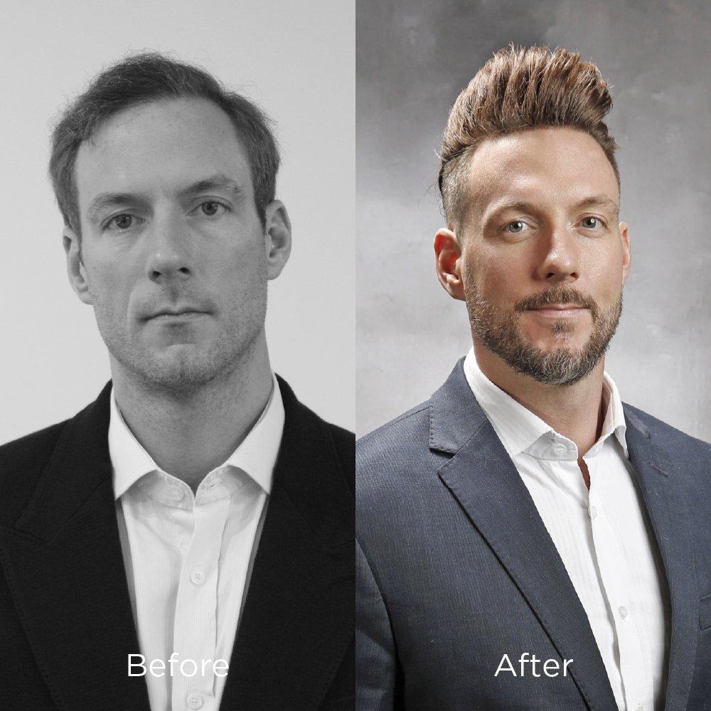 before & after photos 02