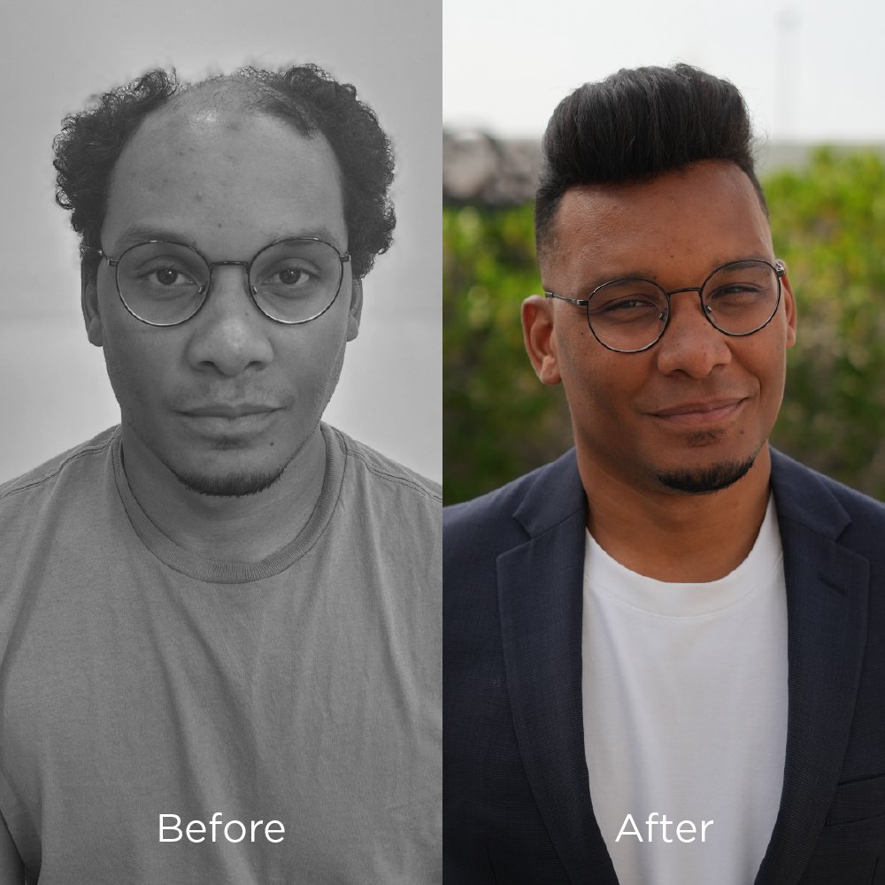 before & after photos 03