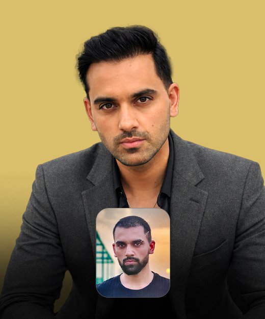 Best Hair Transplant Near me_10